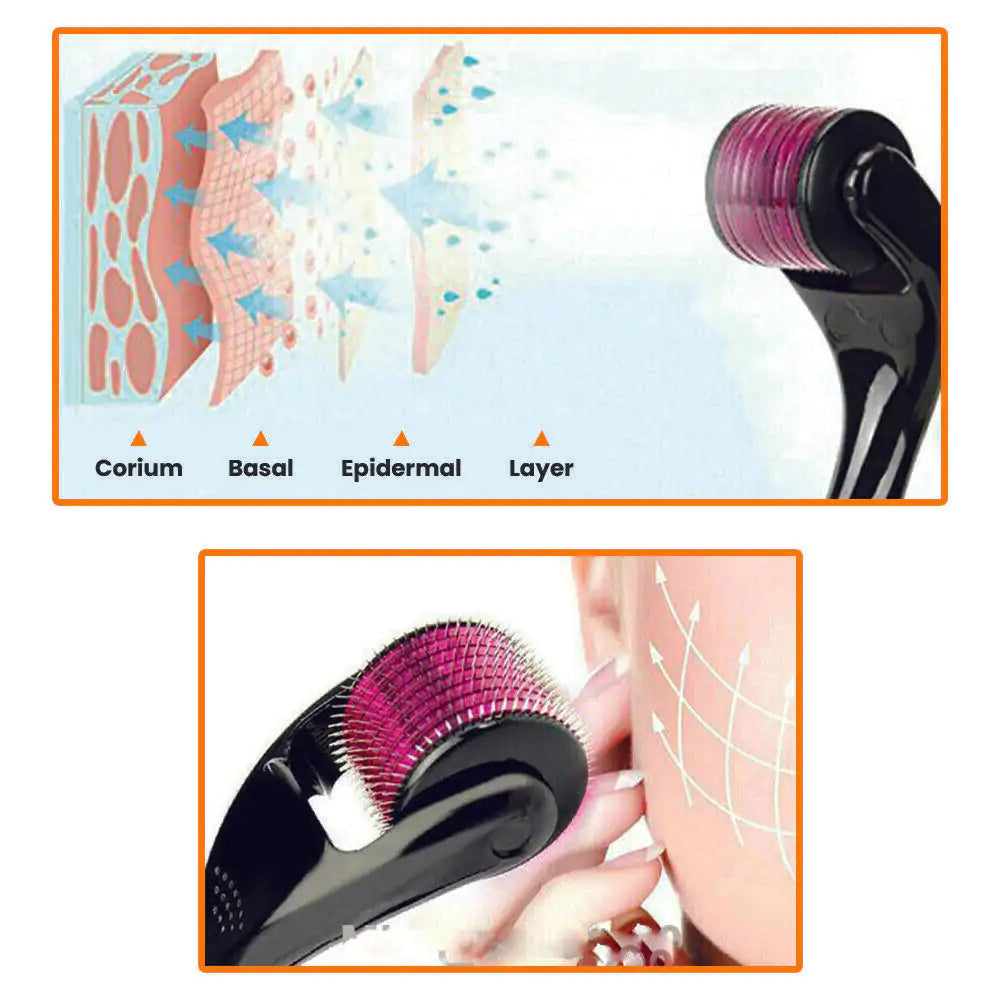 Titanium Microneedle Derma Roller - Sno's Finds